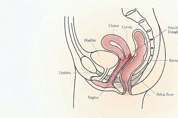 Side-view illustration of the female pelvis showing the structures involved in deep pain during sex: uterus, bladder, bowel, pelvic floor, and the Pouch of Douglas