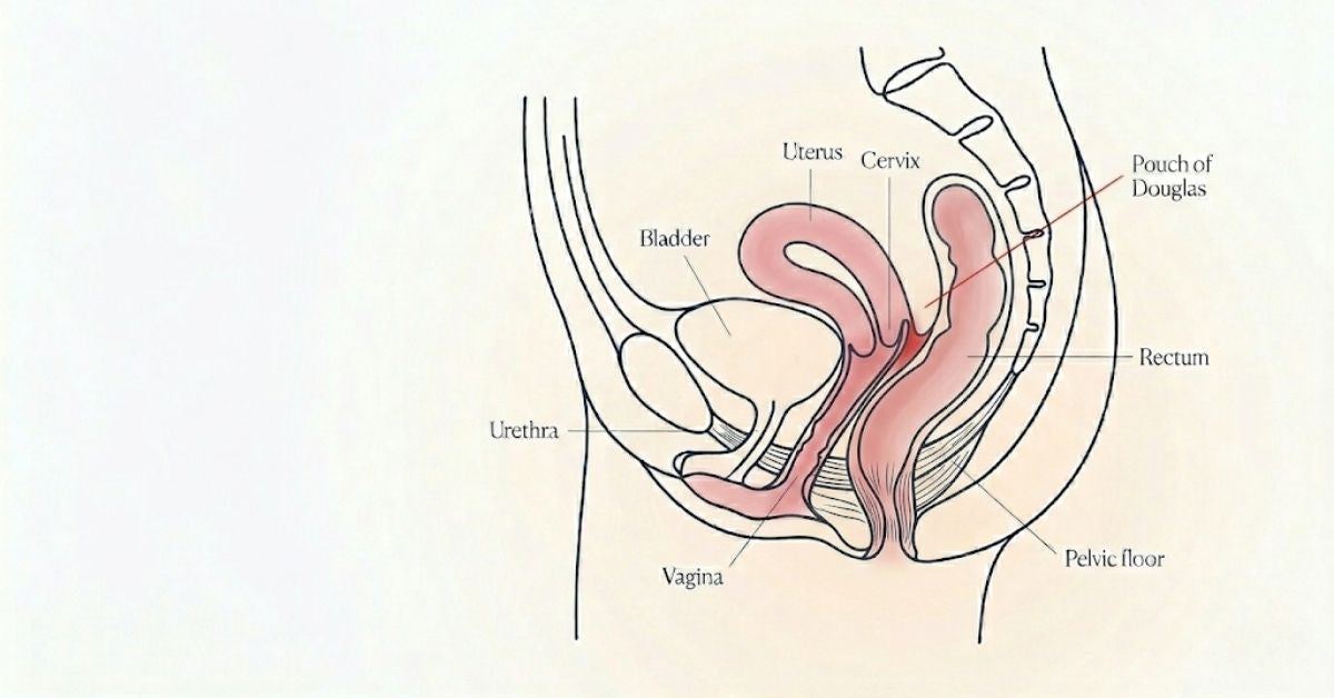 Side-view illustration of the female pelvis showing the structures involved in deep pain during sex: uterus, bladder, bowel, pelvic floor, and the Pouch of Douglas