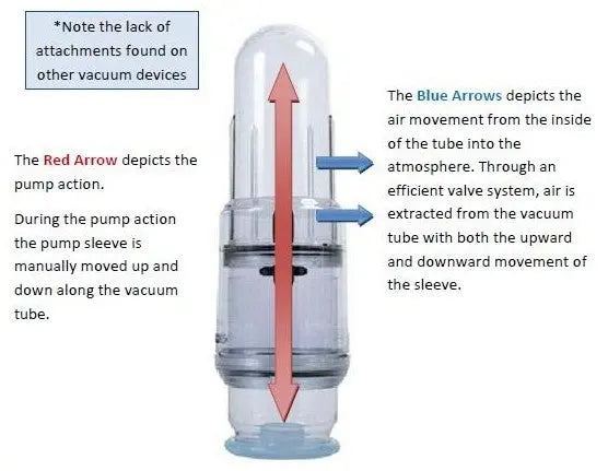 Vacurect — Medical-Grade Vacuum Erection Device